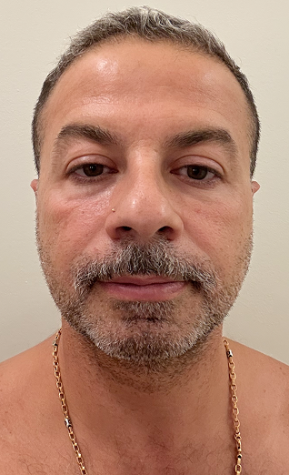DAY 1