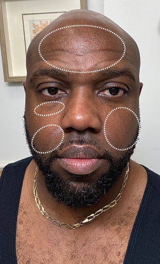 DAY 10